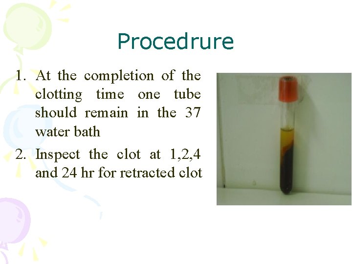 Procedrure 1. At the completion of the clotting time one tube should remain in