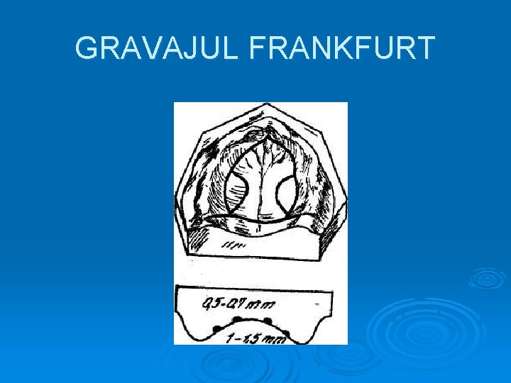 GRAVAJUL FRANKFURT 