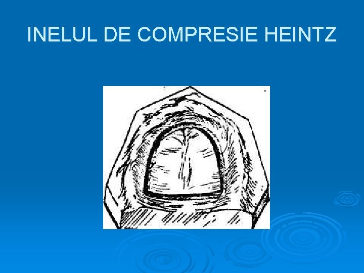 INELUL DE COMPRESIE HEINTZ 