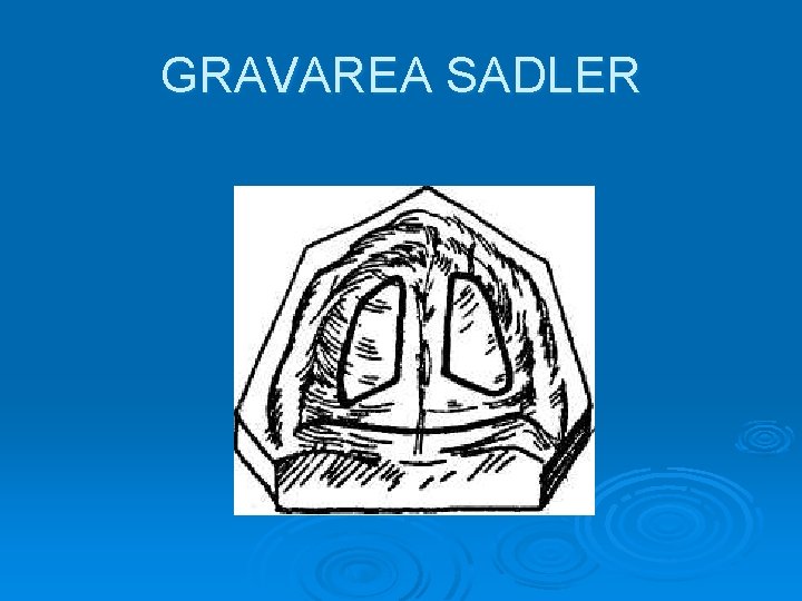 GRAVAREA SADLER 