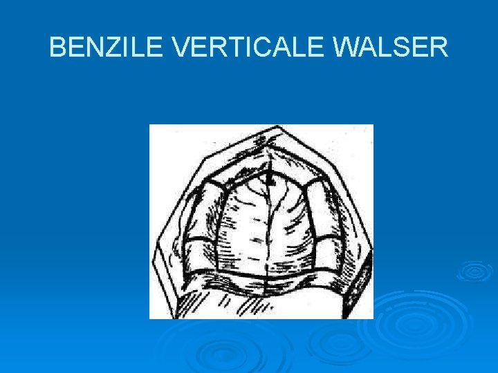 BENZILE VERTICALE WALSER 