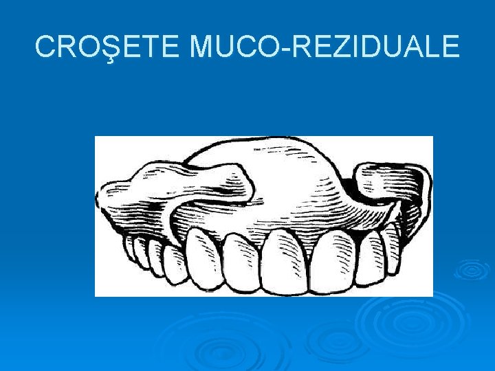 CROŞETE MUCO-REZIDUALE 