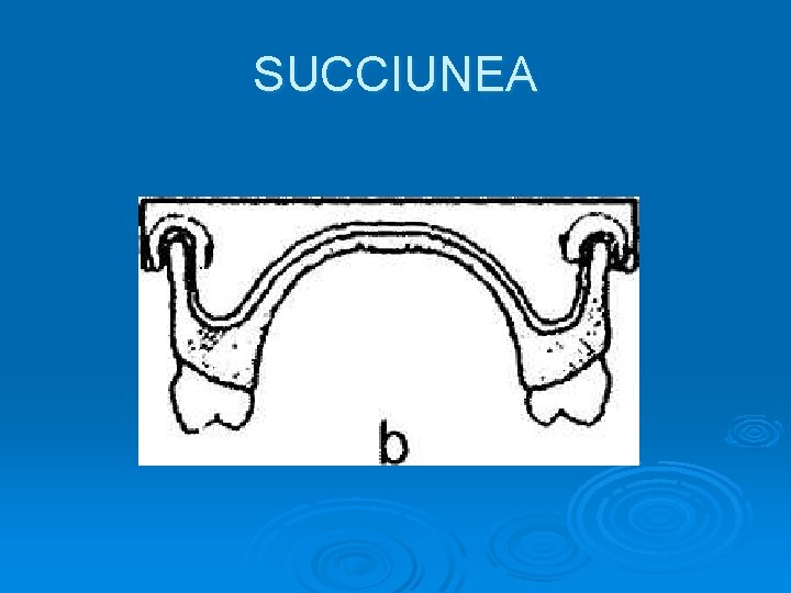 SUCCIUNEA 