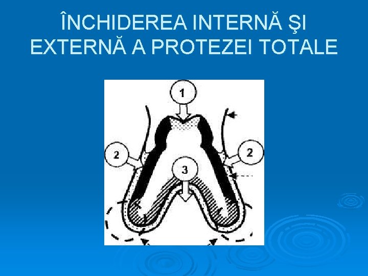 ÎNCHIDEREA INTERNĂ ŞI EXTERNĂ A PROTEZEI TOTALE 