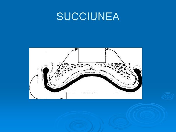 SUCCIUNEA 