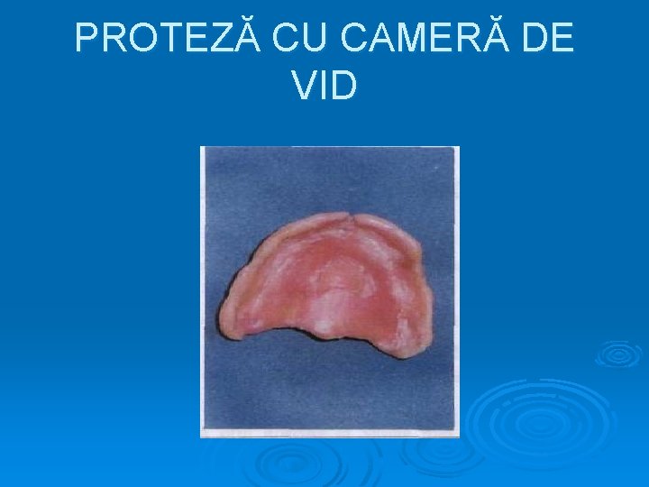 PROTEZĂ CU CAMERĂ DE VID 