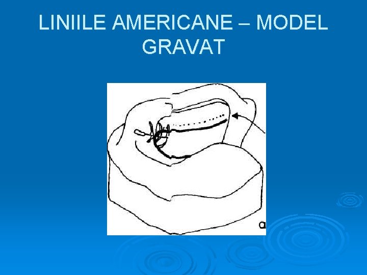 LINIILE AMERICANE – MODEL GRAVAT 