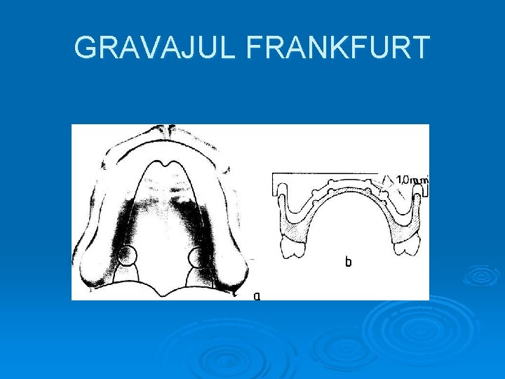 GRAVAJUL FRANKFURT 