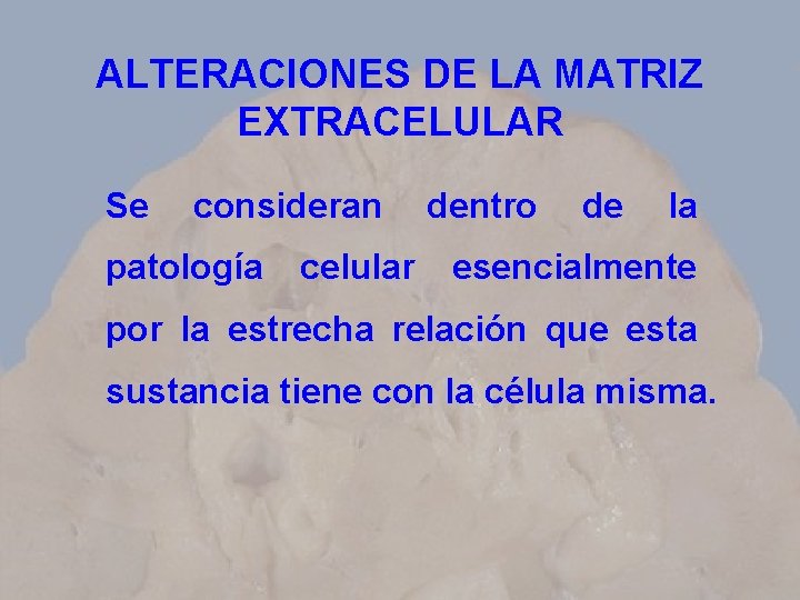 ALTERACIONES DE LA MATRIZ EXTRACELULAR Se consideran patología celular dentro de la esencialmente por