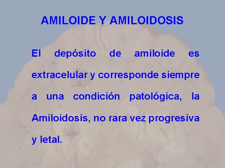 AMILOIDE Y AMILOIDOSIS El depósito de amiloide es extracelular y corresponde siempre a una