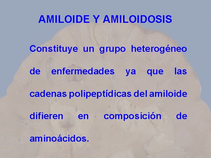 AMILOIDE Y AMILOIDOSIS Constituye un grupo heterogéneo de enfermedades ya que las cadenas polipeptídicas