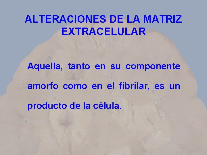 ALTERACIONES DE LA MATRIZ EXTRACELULAR Aquella, tanto en su componente amorfo como en el