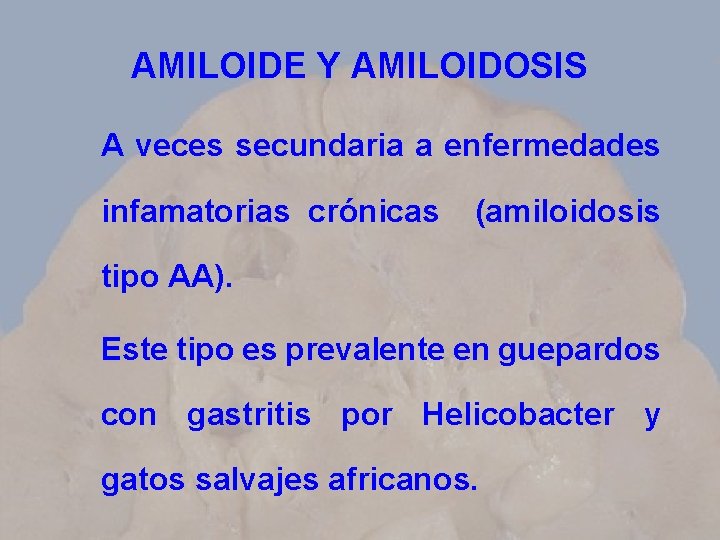 AMILOIDE Y AMILOIDOSIS A veces secundaria a enfermedades infamatorias crónicas (amiloidosis tipo AA). Este