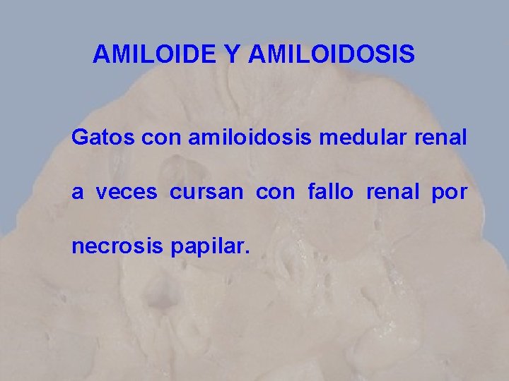 AMILOIDE Y AMILOIDOSIS Gatos con amiloidosis medular renal a veces cursan con fallo renal