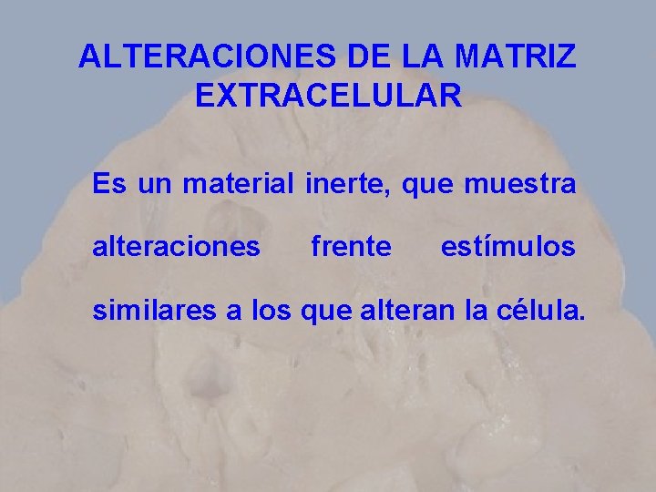 ALTERACIONES DE LA MATRIZ EXTRACELULAR Es un material inerte, que muestra alteraciones frente estímulos