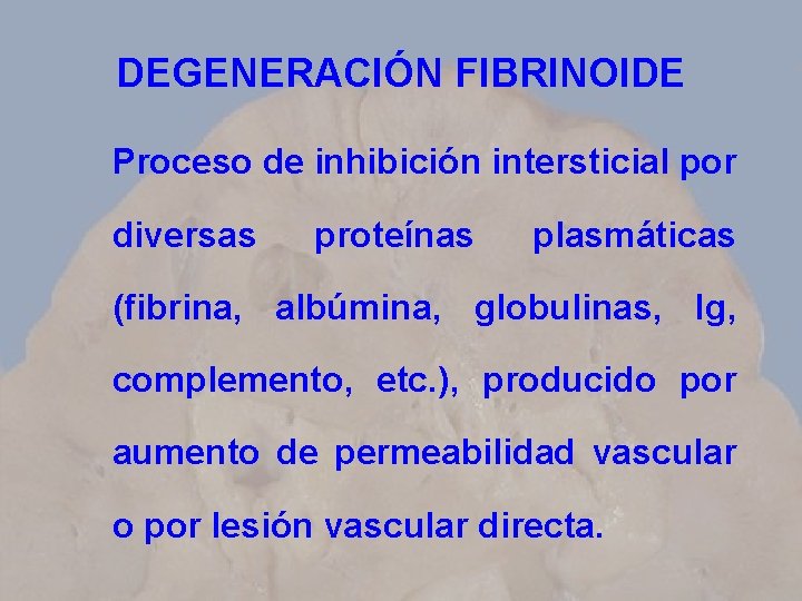 DEGENERACIÓN FIBRINOIDE Proceso de inhibición intersticial por diversas proteínas plasmáticas (fibrina, albúmina, globulinas, Ig,