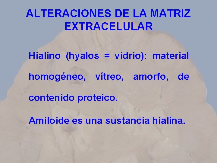 ALTERACIONES DE LA MATRIZ EXTRACELULAR Hialino (hyalos = vidrio): material homogéneo, vítreo, amorfo, de