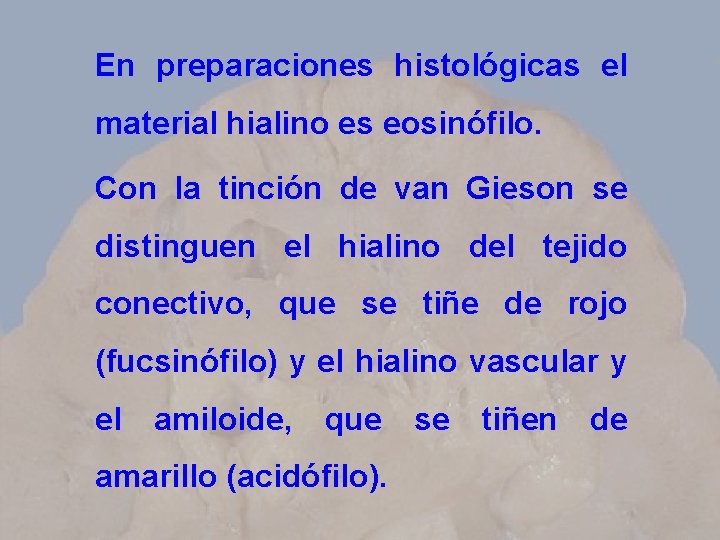En preparaciones histológicas el material hialino es eosinófilo. Con la tinción de van Gieson