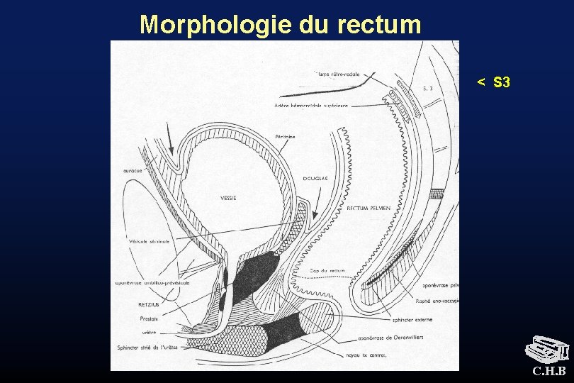 Morphologie du rectum < S 3 C. H. B 