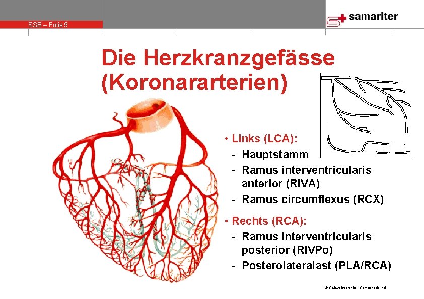 SSB – Folie 9 Die Herzkranzgefässe (Koronararterien) • Links (LCA): - Hauptstamm - Ramus