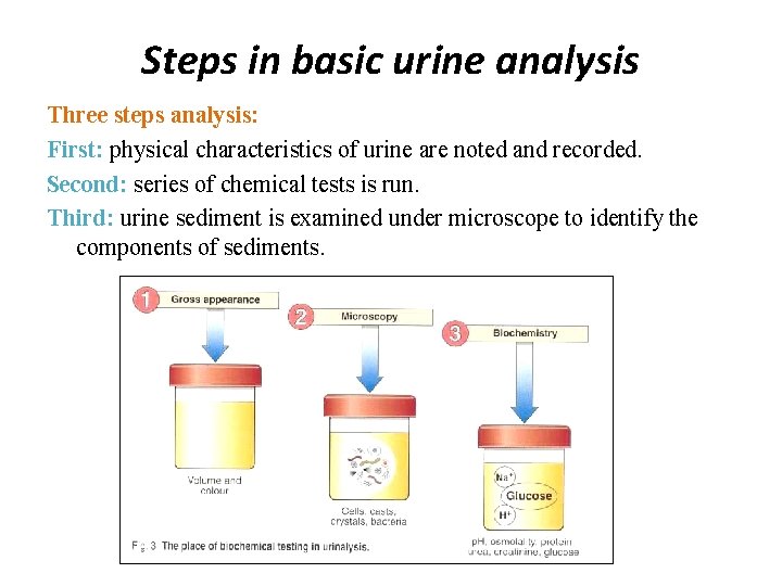 Steps in basic urine analysis Three steps analysis: First: physical characteristics of urine are Steps in basic urine analysis Three steps analysis: First: physical characteristics of urine are