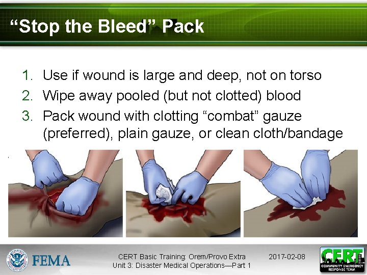 “Stop the Bleed” Pack 1. Use if wound is large and deep, not on