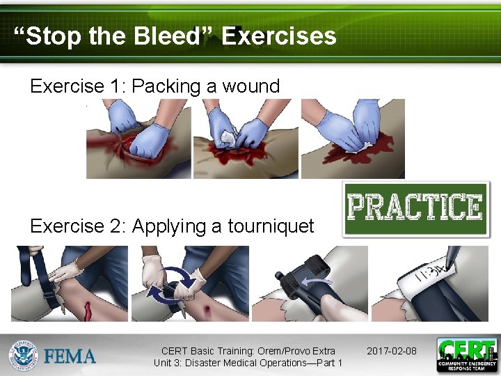 “Stop the Bleed” Exercises Exercise 1: Packing a wound Exercise 2: Applying a tourniquet