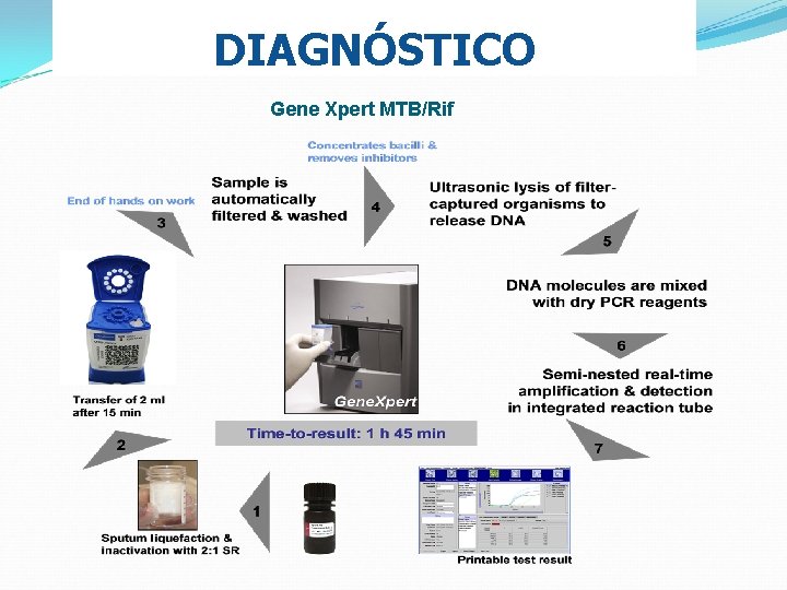 DIAGNÓSTICO Gene Xpert MTB/Rif 