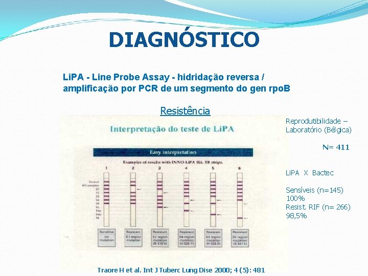 DIAGNÓSTICO Li. PA - Line Probe Assay - hidridação reversa / amplificação por PCR