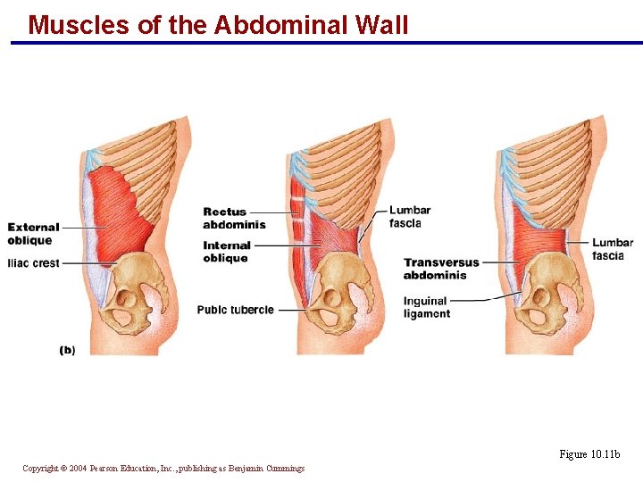 Muscles of the Abdominal Wall Figure 10. 11 b Copyright © 2004 Pearson Education,