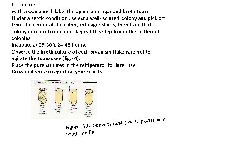 Procedure With a wax pencil , label the agar slants agar and broth tubes.