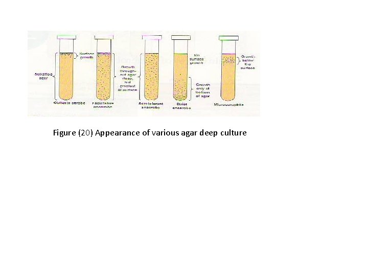 Figure (20) Appearance of various agar deep culture 