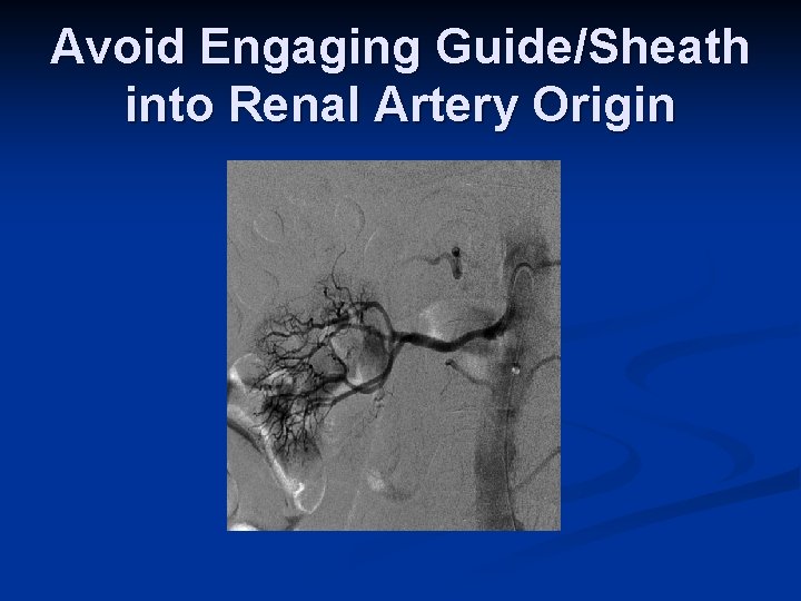 Avoid Engaging Guide/Sheath into Renal Artery Origin 