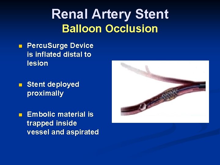 Renal Artery Stent Balloon Occlusion n Percu. Surge Device is inflated distal to lesion