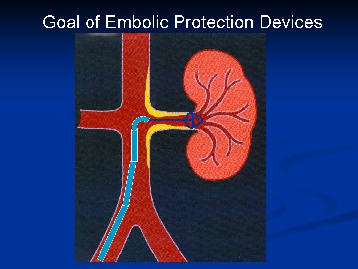 Goal of Embolic Protection Devices 