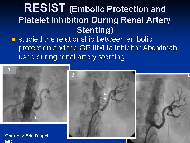 RESIST (Embolic Protection and Platelet Inhibition During Renal Artery Stenting) n studied the relationship