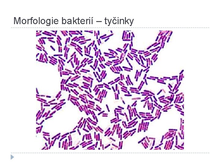 Morfologie bakterií – tyčinky 