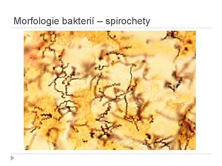 Morfologie bakterií – spirochety 