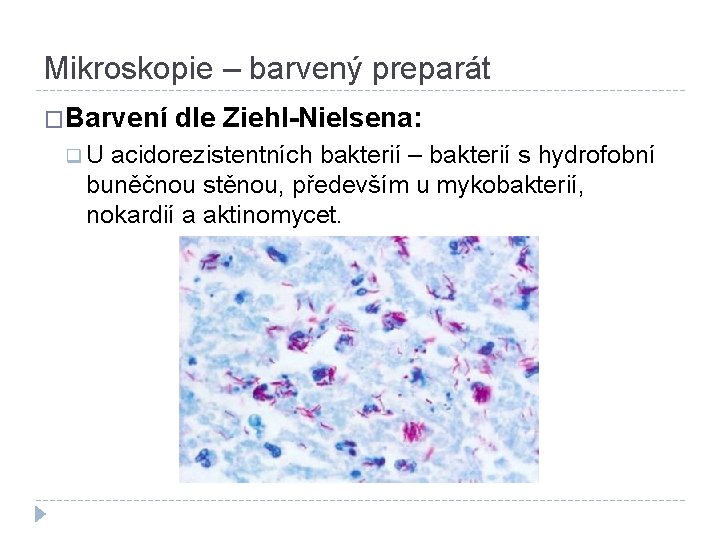 Mikroskopie – barvený preparát �Barvení dle Ziehl-Nielsena: q U acidorezistentních bakterií – bakterií s