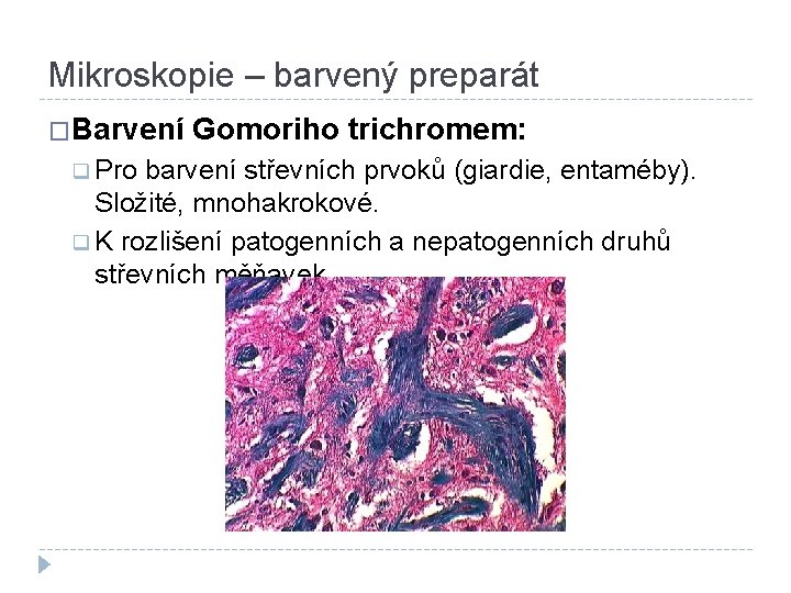 Mikroskopie – barvený preparát �Barvení Gomoriho trichromem: q Pro barvení střevních prvoků (giardie, entaméby).