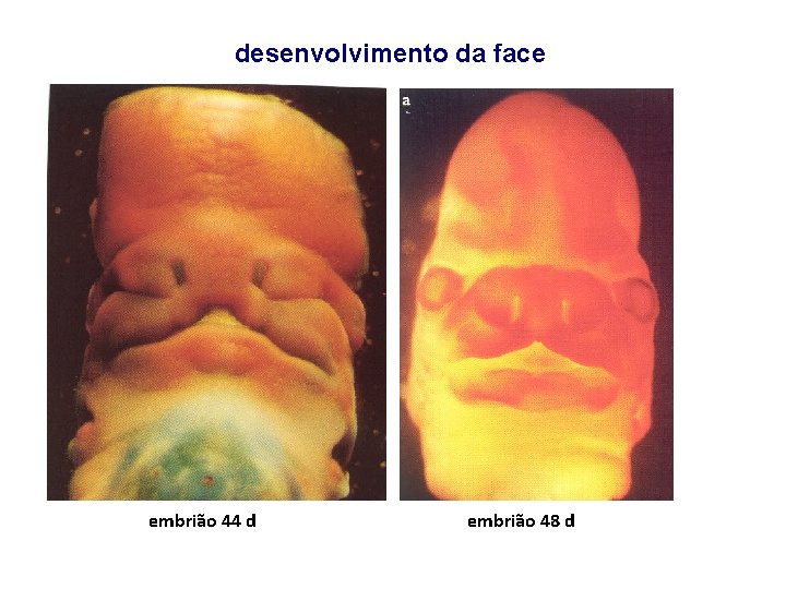 desenvolvimento da face embrião 44 d embrião 48 d 