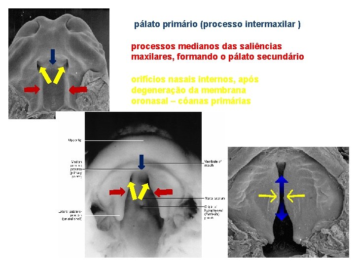 pálato primário (processo intermaxilar ) processos medianos das saliências maxilares, formando o pálato secundário