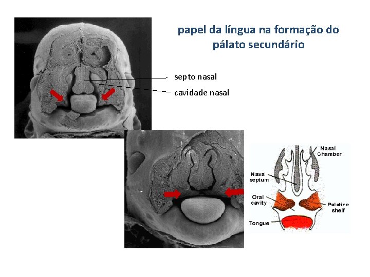 papel da língua na formação do pálato secundário septo nasal cavidade nasal 