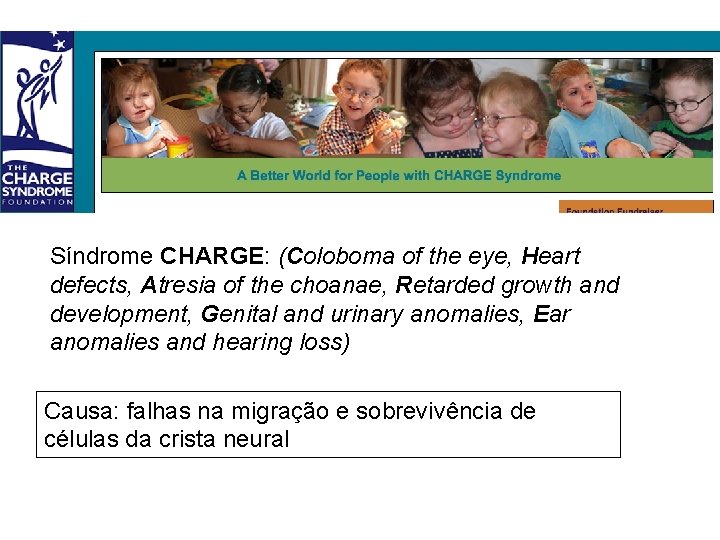 Síndrome CHARGE: (Coloboma of the eye, Heart defects, Atresia of the choanae, Retarded growth