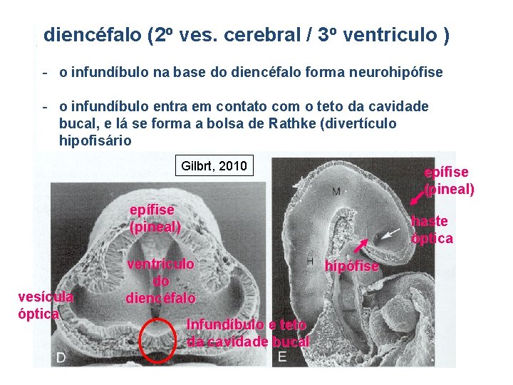 diencéfalo (2 o ves. cerebral / 3 o ventriculo ) - o infundíbulo na