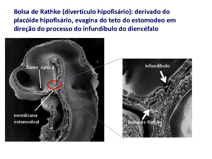 Bolsa de Rathke (divertículo hipofisário): derivado do placóide hipofisário, evagina do teto do estomodeo