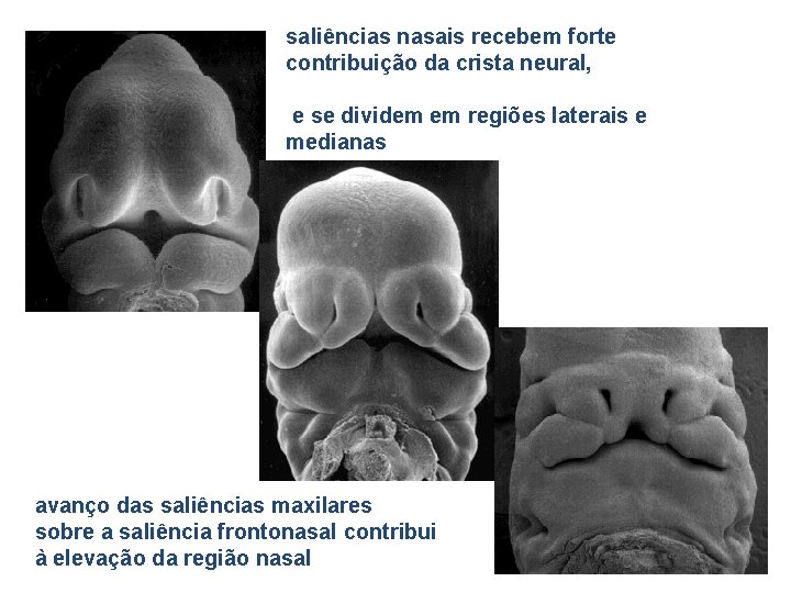 saliências nasais recebem forte contribuição da crista neural, e se dividem em regiões laterais