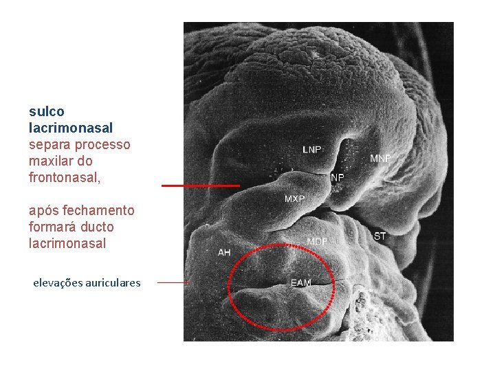 sulco lacrimonasal separa processo maxilar do frontonasal, após fechamento formará ducto lacrimonasal elevações auriculares