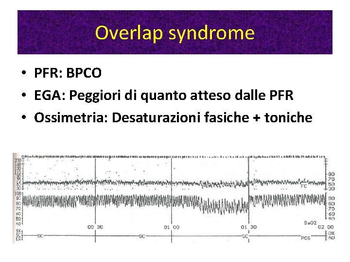 Overlap syndrome • PFR: BPCO • EGA: Peggiori di quanto atteso dalle PFR • Overlap syndrome • PFR: BPCO • EGA: Peggiori di quanto atteso dalle PFR •