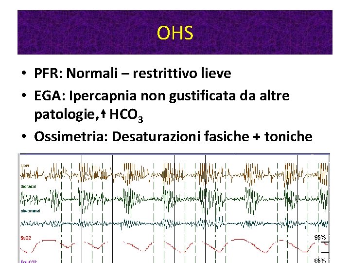 OHS • PFR: Normali – restrittivo lieve • EGA: Ipercapnia non gustificata da altre OHS • PFR: Normali – restrittivo lieve • EGA: Ipercapnia non gustificata da altre